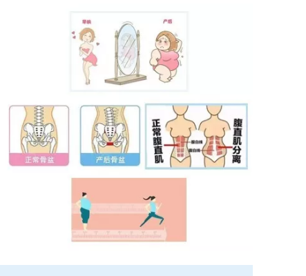 為什么便攜式產后康復治療儀能被這么多產后修復中心接受？這就是原因