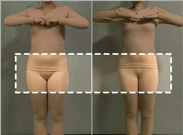 女性產(chǎn)后子宮收縮不好，會(huì)給子宮留下后患之憂，醫(yī)生媽媽建議早點(diǎn)使用子宮復(fù)舊儀