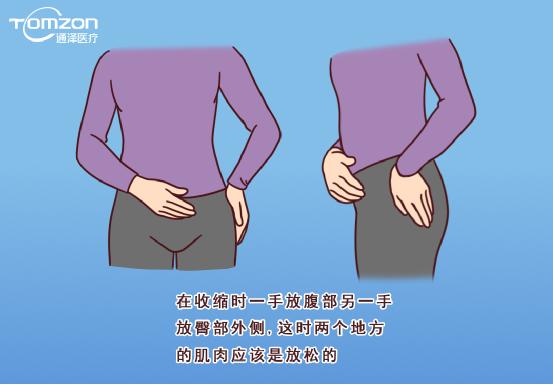 盆底康復(fù)治療儀能不能改善腹直肌分離？