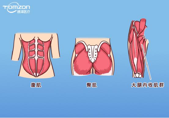 凱格爾運(yùn)動(dòng)該怎么做？盆底肌修復(fù)儀器效果會(huì)更好嗎？